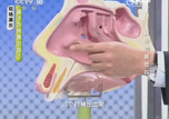 《健康之路》鼻出血莫忽视