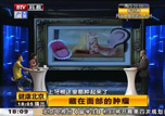 藏在面部的肿瘤